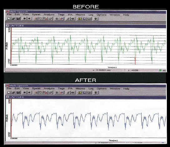 sonograms